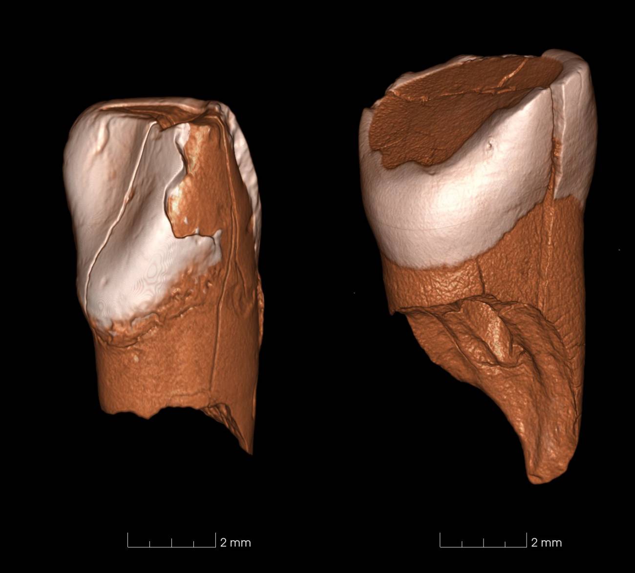 Dos dientes de 41.000 años de edad revelan la llegada de los humanos modernos a Europa