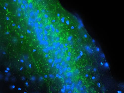 El hipocampo y la corteza cerebral cooperan durante la ansiedad