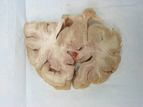 El miedo del cerebro está equipado con un sensor de ahogamiento integrado