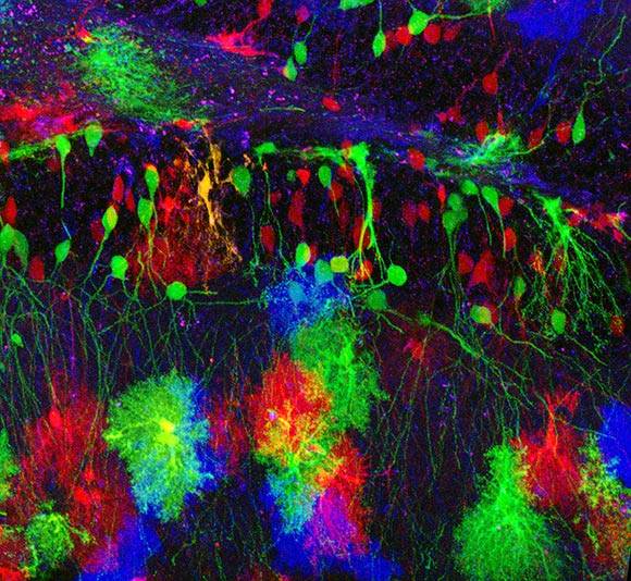 Identifican el gen que regula el desarrollo del cerebro humano