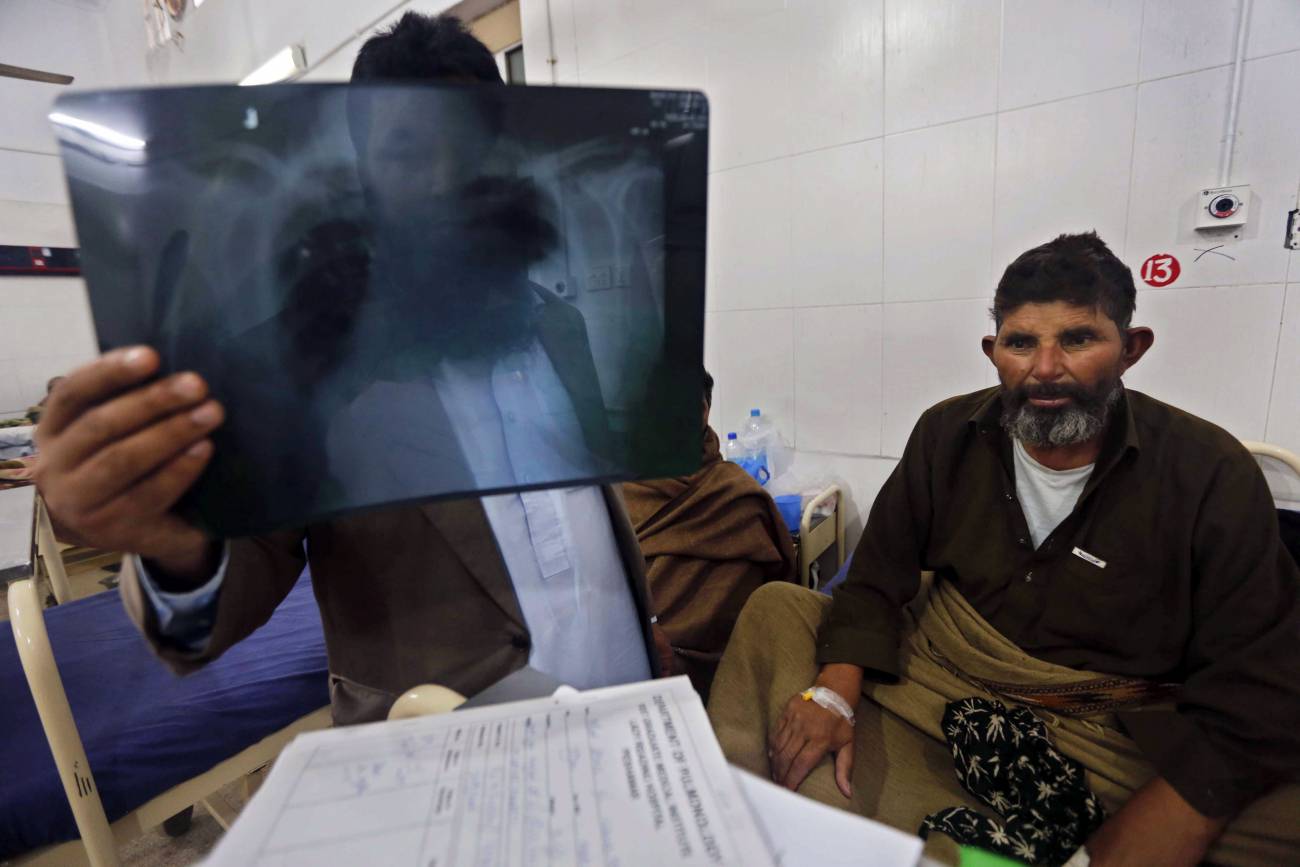 La OMS se propone acabar con la tuberculosis en 2050 