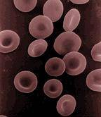 La proteína GLRX5, clave para el desarrollo de una forma genética de la anemia