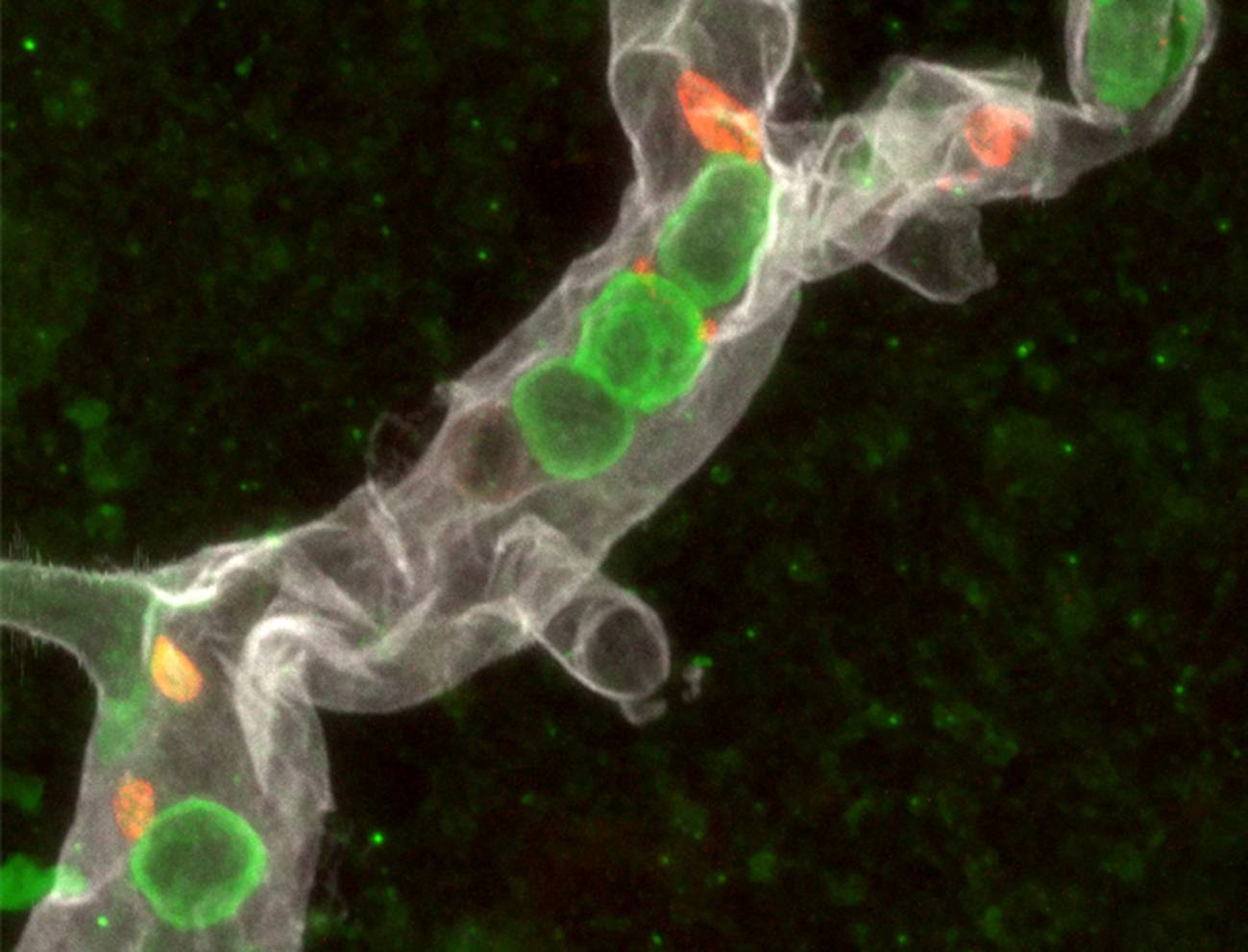 Los glóbulos blancos ‘escanean’ la sangre para provocar ictus