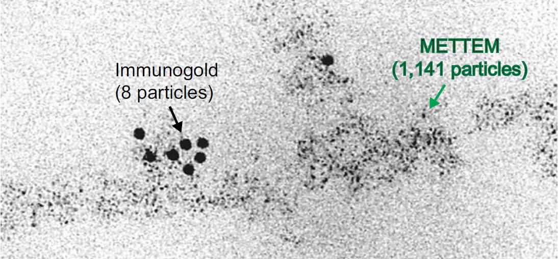 Detección de proteínas por microscopía electrónica