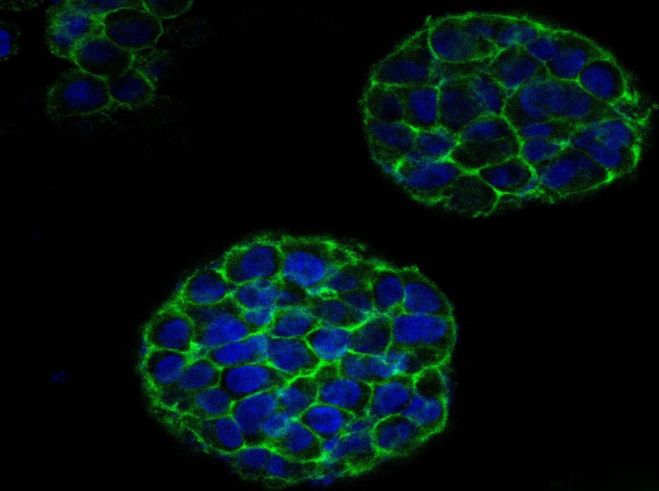 Tumores salidos de una impresora 3D ayudarán a estudiar el cáncer de cérvix