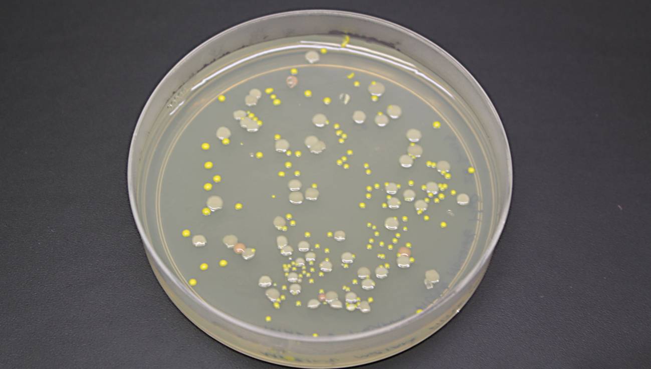 Cultivos bacterianos provenientes de las muestras.