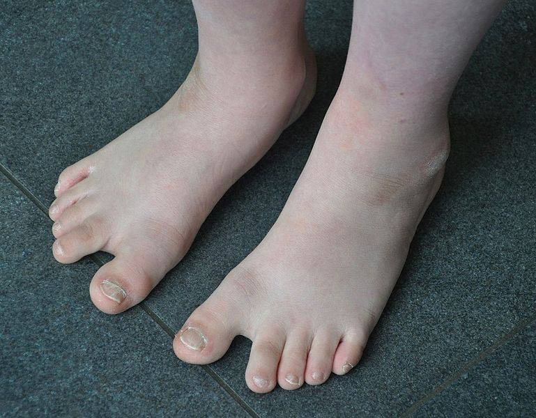 pies