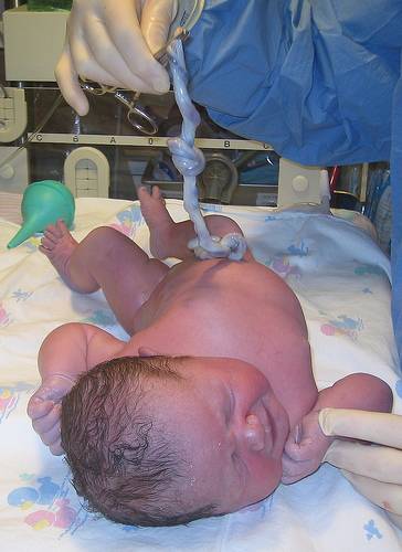 Una técnica pionera mejora el tratamiento de la leucemia a partir de sangre de cordón umbilical