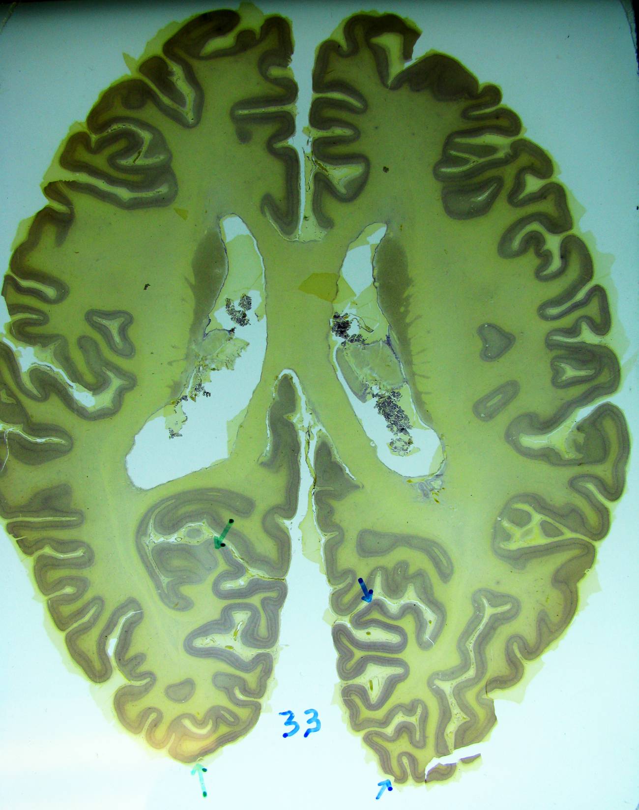 El cerebro adulto se transforma a una velocidad insospechada