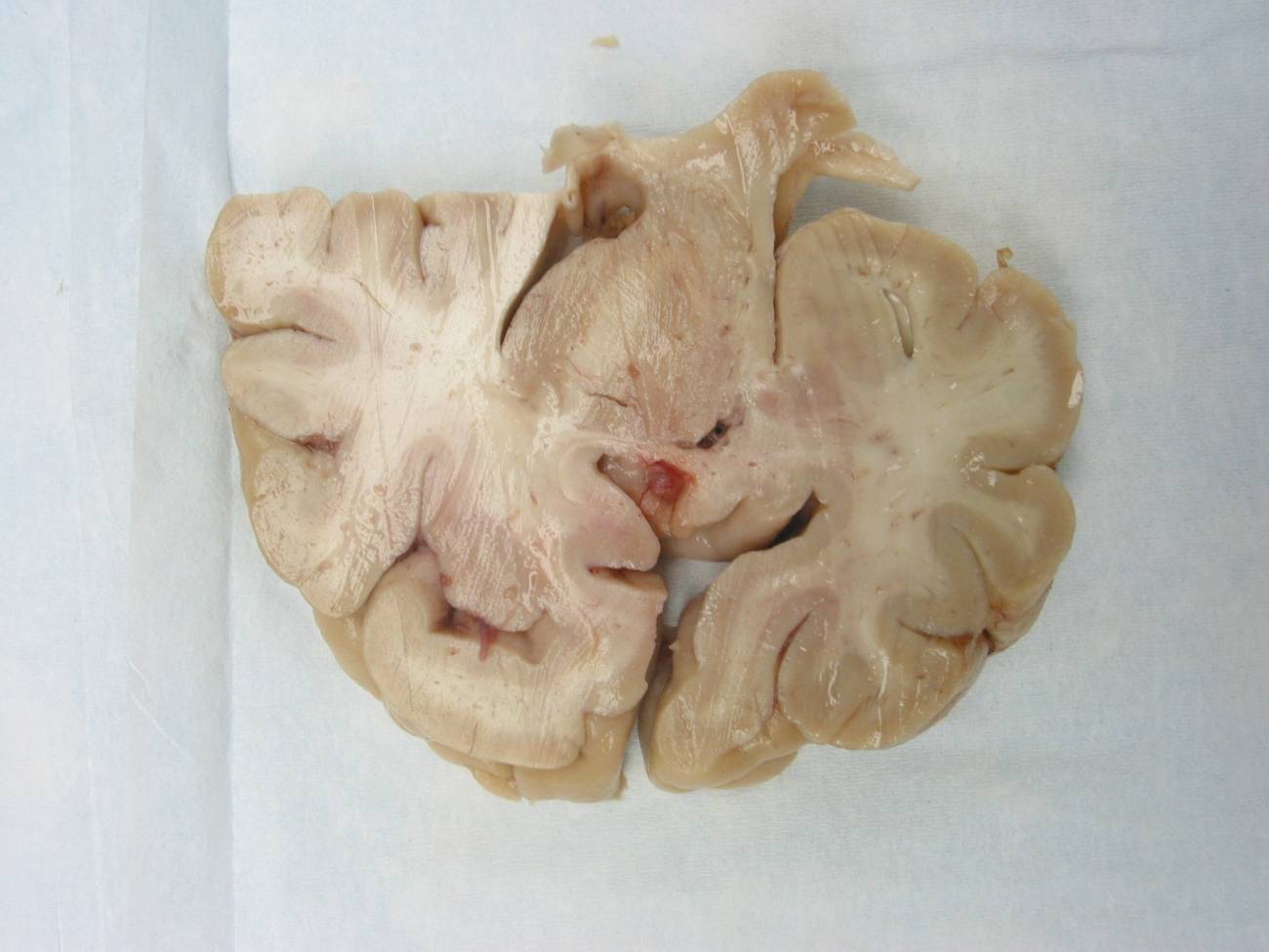 El miedo del cerebro está equipado con un sensor de ahogamiento integrado