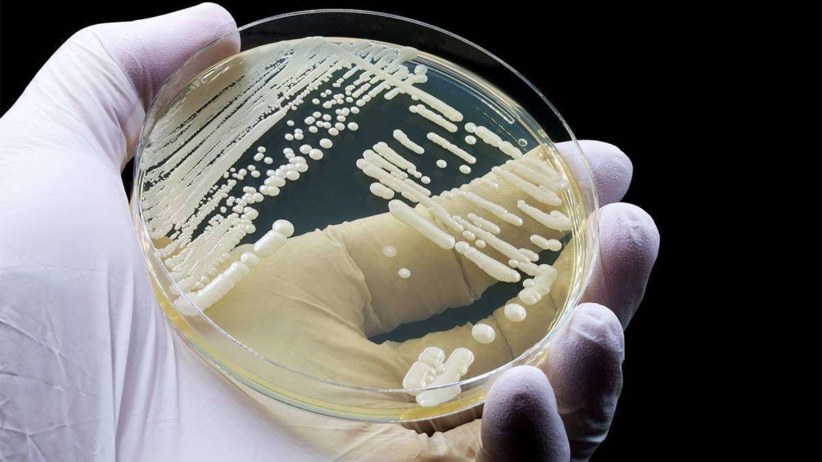‘Candidozyma auris’, el peligroso patógeno que surgió del cambio climático