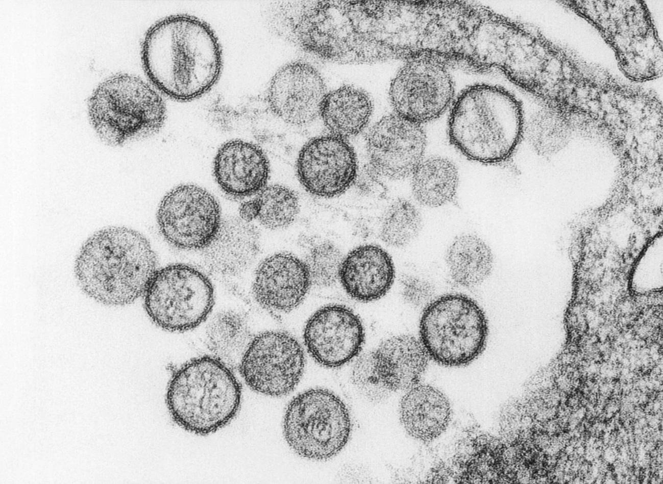 El ‘sorteo genético’: ¿por qué el hantavirus es más letal para algunas personas que para otras?