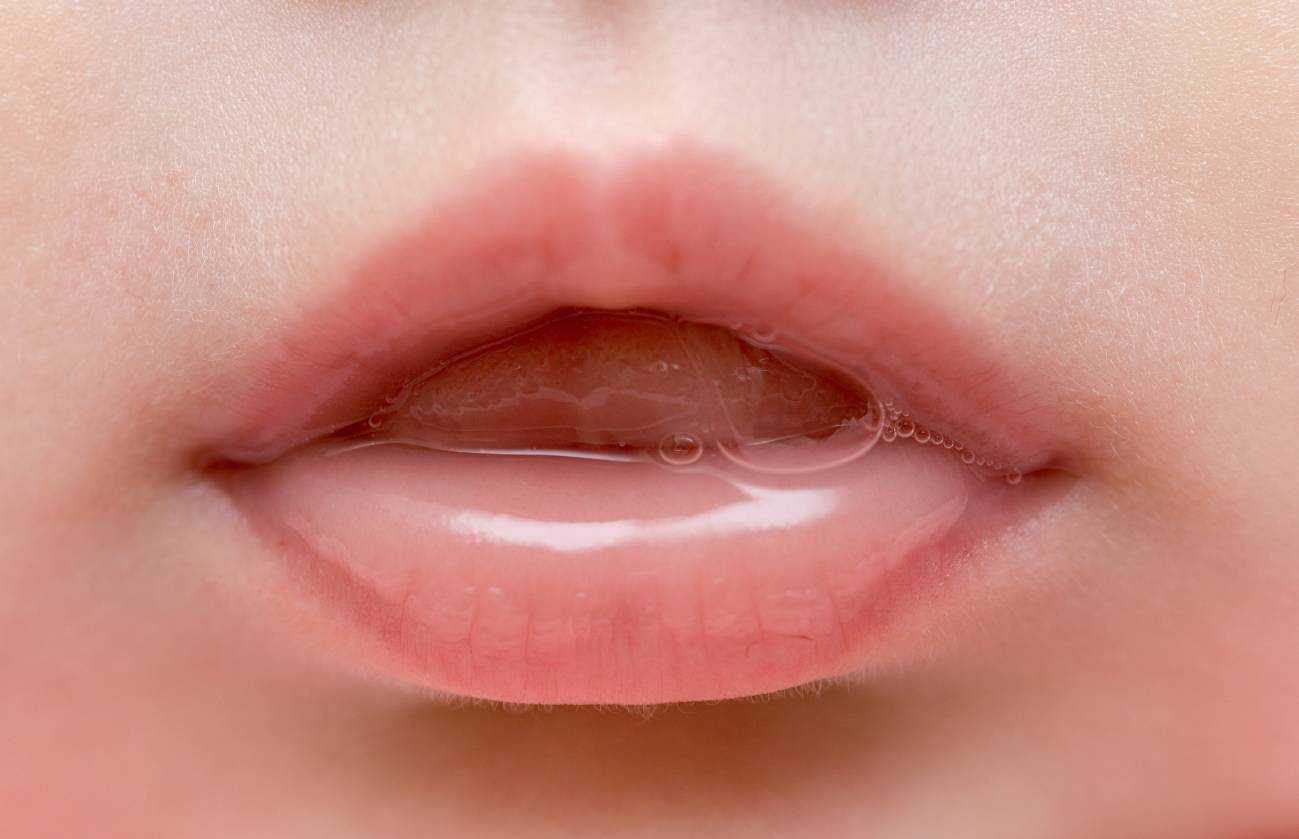 Fabricantes de saliva: ingeniería de tejidos contra la boca seca 