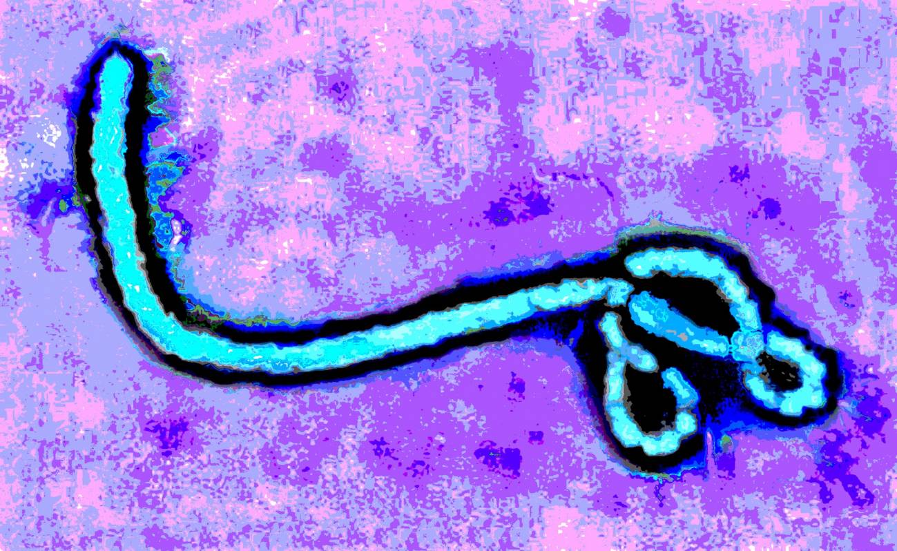 La eficacia de los anticuerpos de ébola en supervivientes aumenta con el tiempo