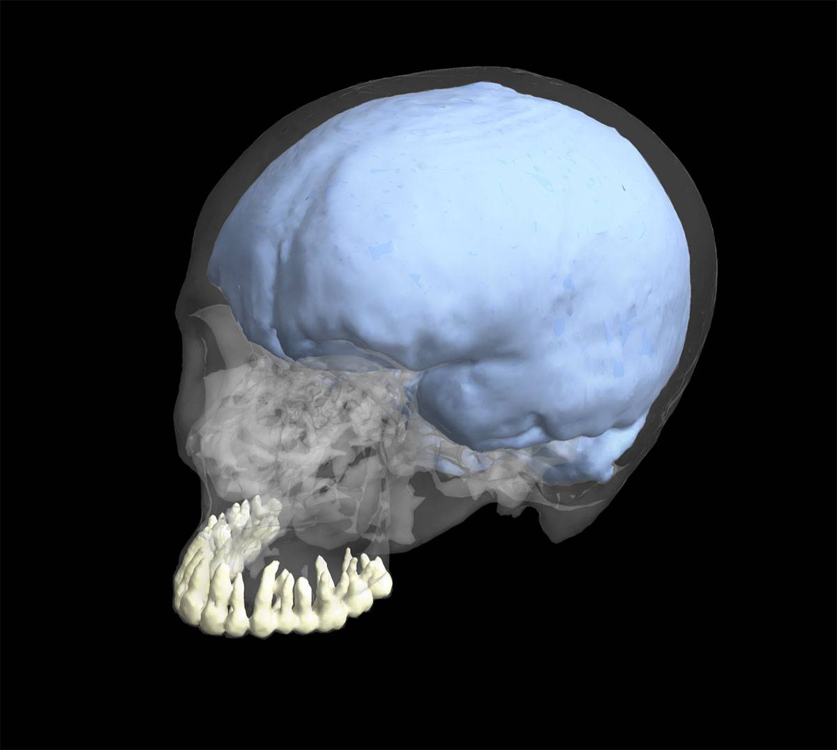 La evolución de los dientes y del cerebro no fueron de la mano