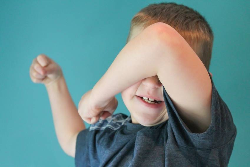 La neuroimagen permite predecir autismo en bebés de alto riesgo
