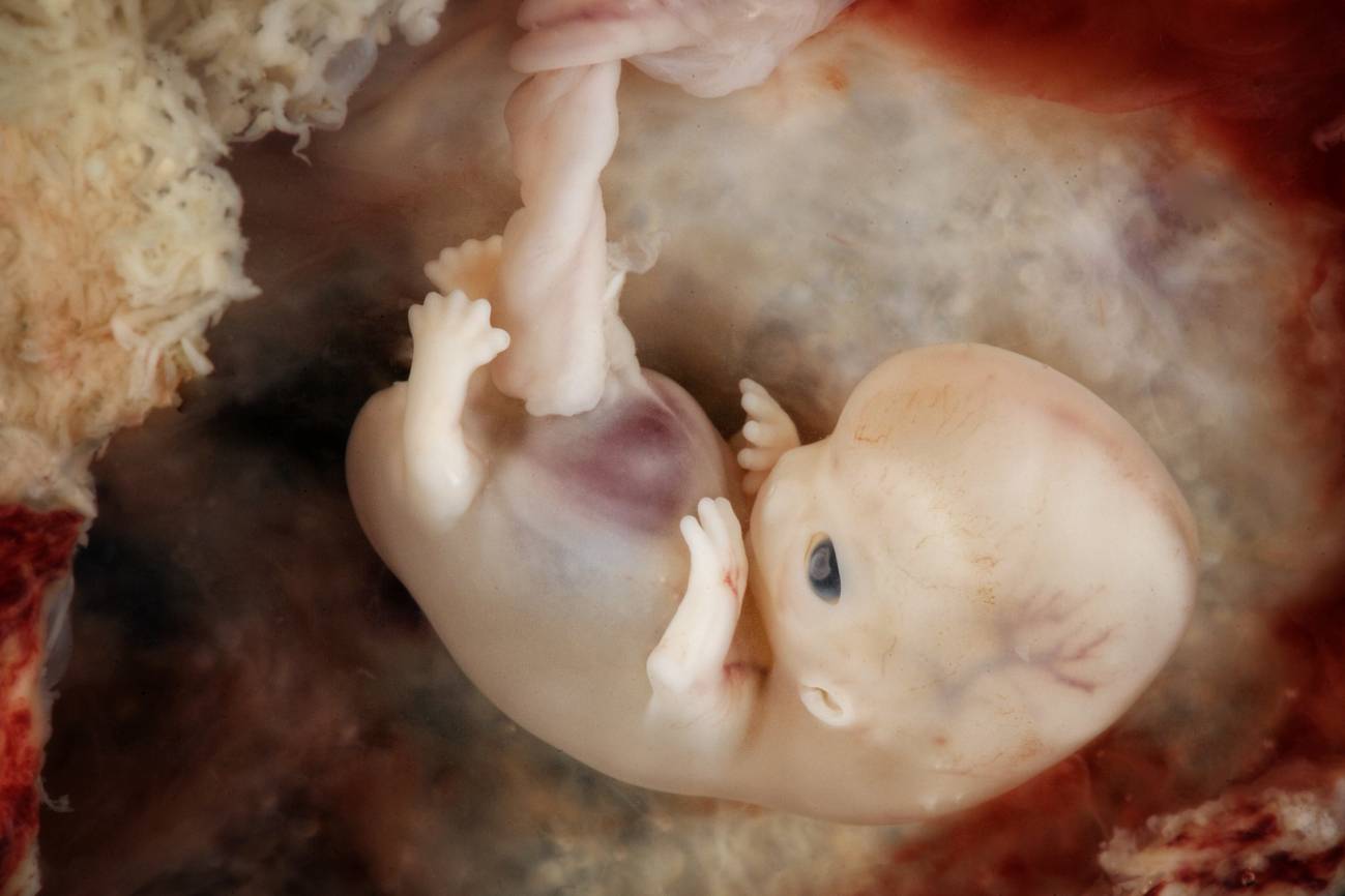 La placenta donde creciste te pudo cambiar la vida
