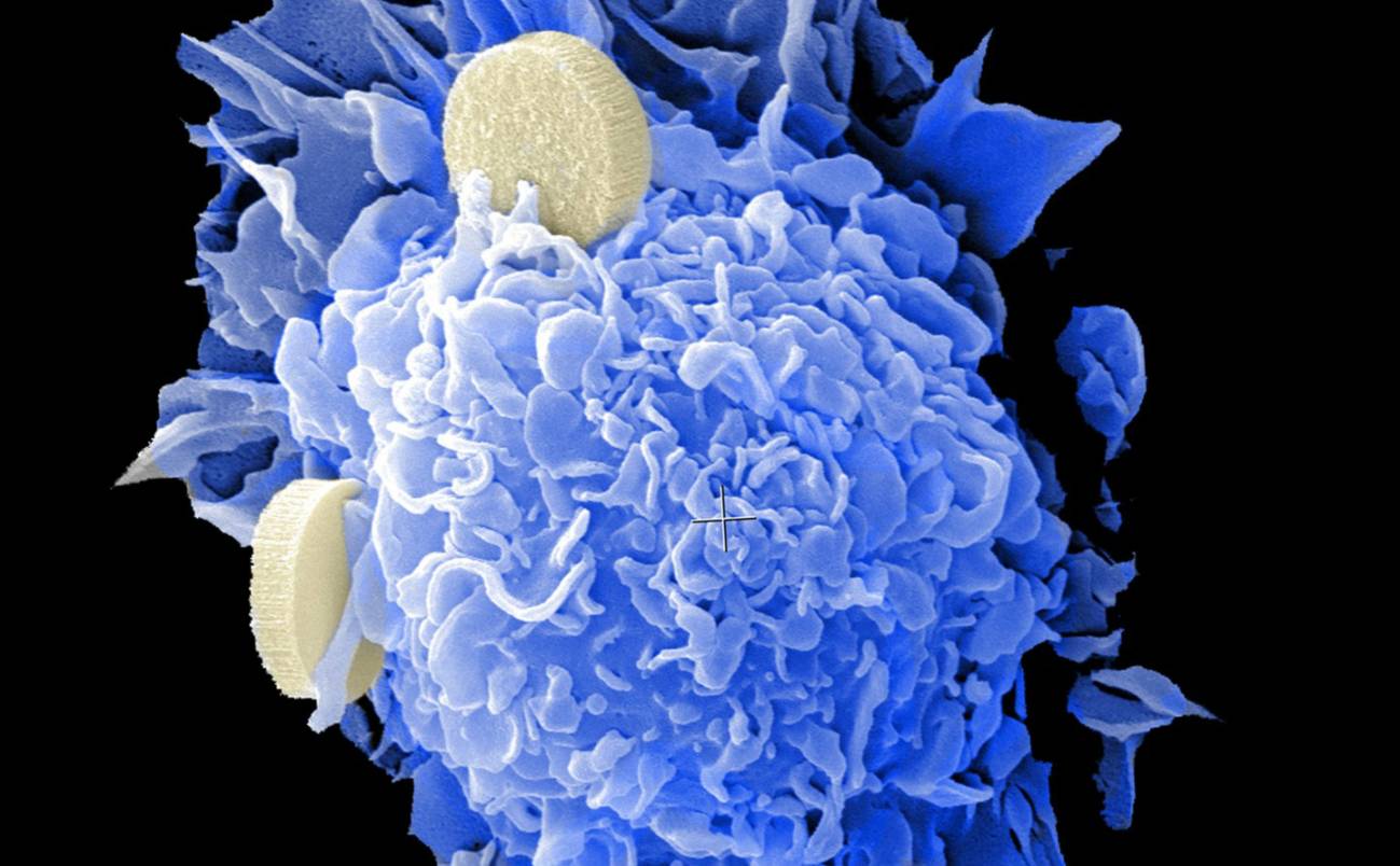 Las vacunas contra el cáncer empiezan su segunda vida 