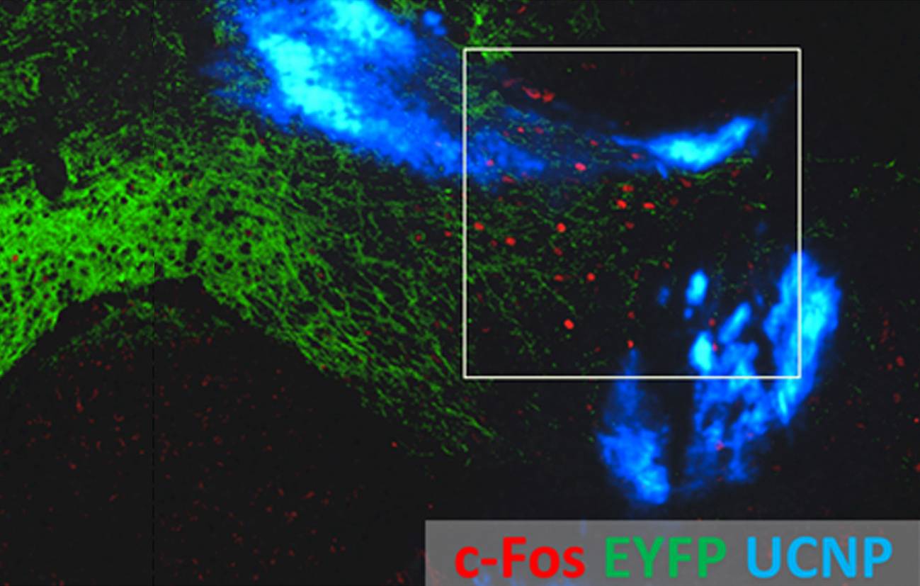Luz y nanopartículas para estimular las profundidades del cerebro