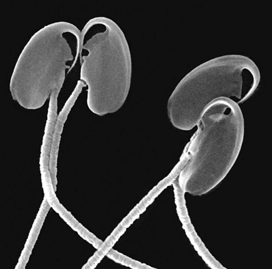 ‘Trenes’ de espermatozoides para llegar más rápido al óvulo