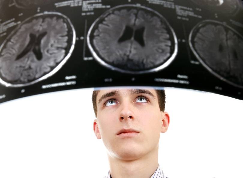 ¿Tu cerebro es mayor de edad?