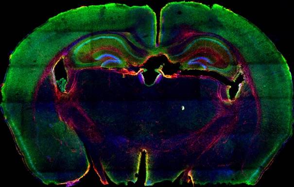 Un nuevo modelo tumoral acelera el tratamiento del cáncer