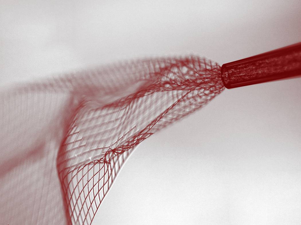 Una minúscula red flexible de electrodos para ser inyectada en el cerebro