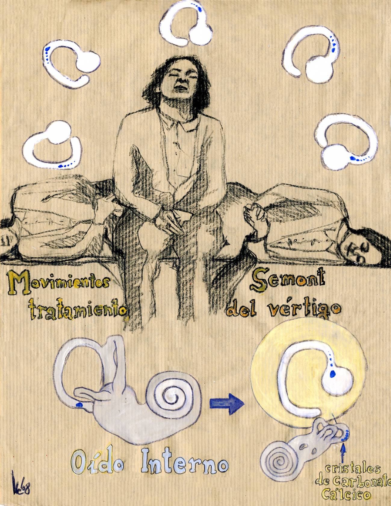Se puede tratar rápida y fácilmente el vértigo