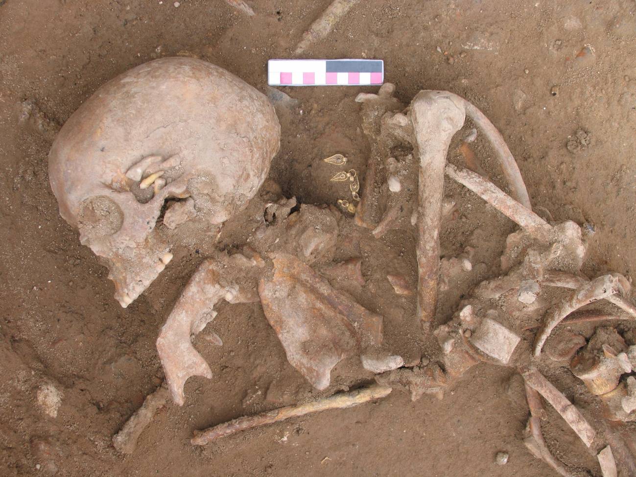 El análisis genético permitió identificar dos hermanos, enterrados en los yacimientos de Castelló y Mérida, separados por unos 725 kilómetros siguiendo la red viaria romana. / Cell, Carrión et al.