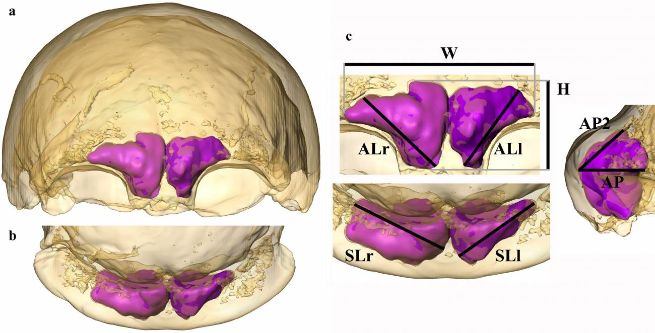 Visualización y cuantificación de los senos frontales. / Balzeau et al., Sci. Adv.