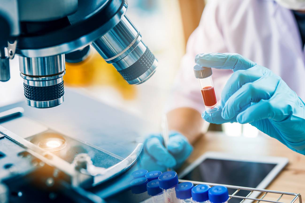 El estudio marca posibles biomarcadores de diagnóstico e información de tratamiento. / Adobe Stock