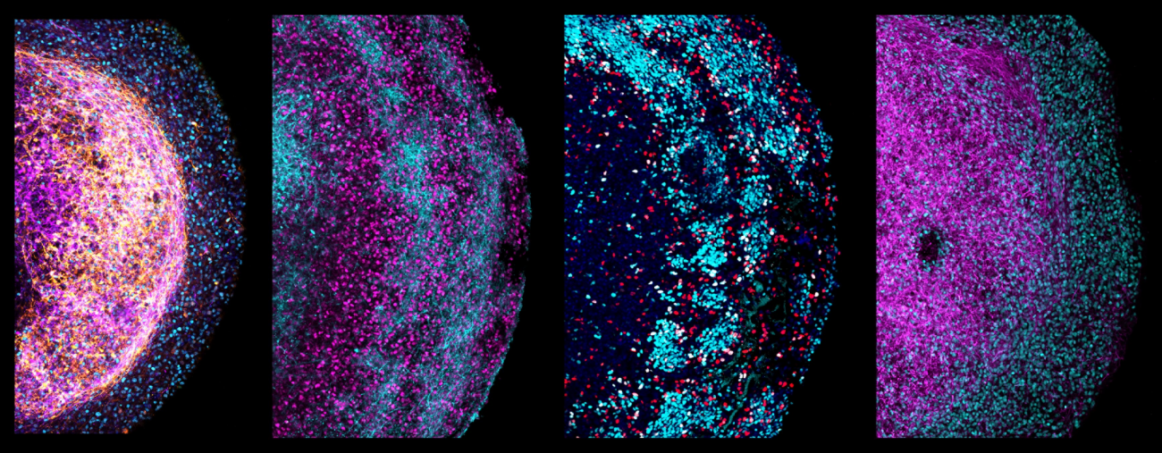 Partes de diferentes organoides cerebrales fetales humanos