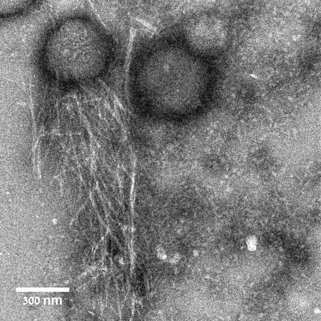 Células bacterianas