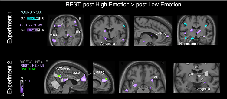 La imagen superior muestra las distintas activaciones cerebrales en el experimento uno y la inferior en el experimento dos.  / Baez-Lugo et al., Nature Aging