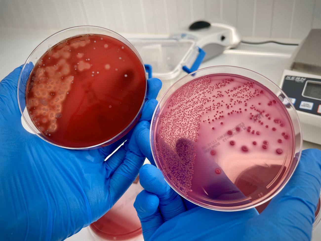 Cultivos de bacterias procedentes de las heces de un donante. / Cristina Sáez / SINC