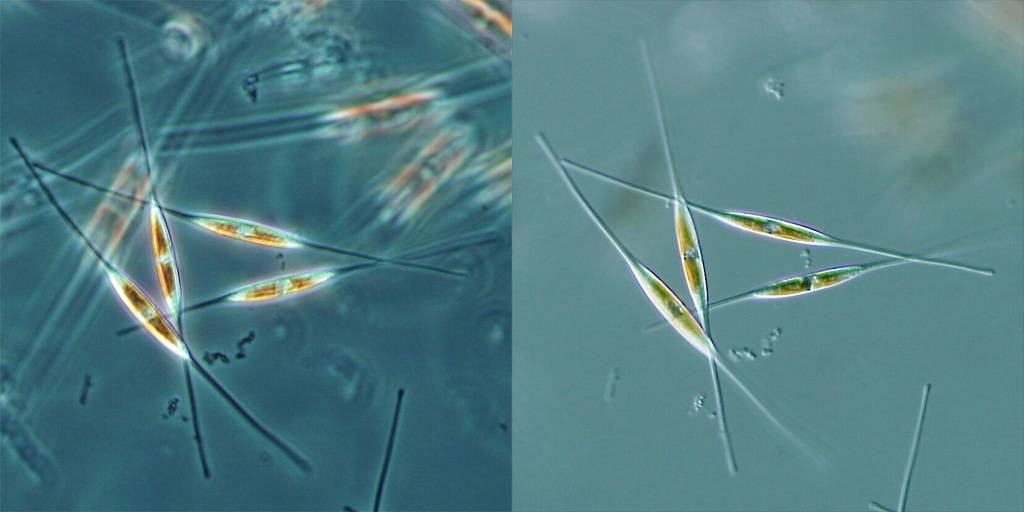 Diatomeas bajo el microscopio. / WIkipedia
