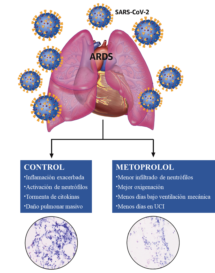 Esquema con las diferencias entre los pacientes control y los tratados con metoprolol