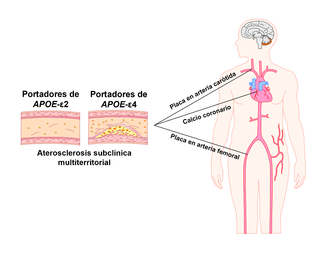 esquema de APOE
