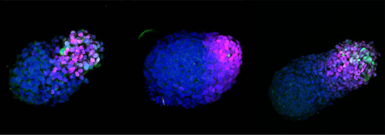 Gastruloide humano en crecimiento