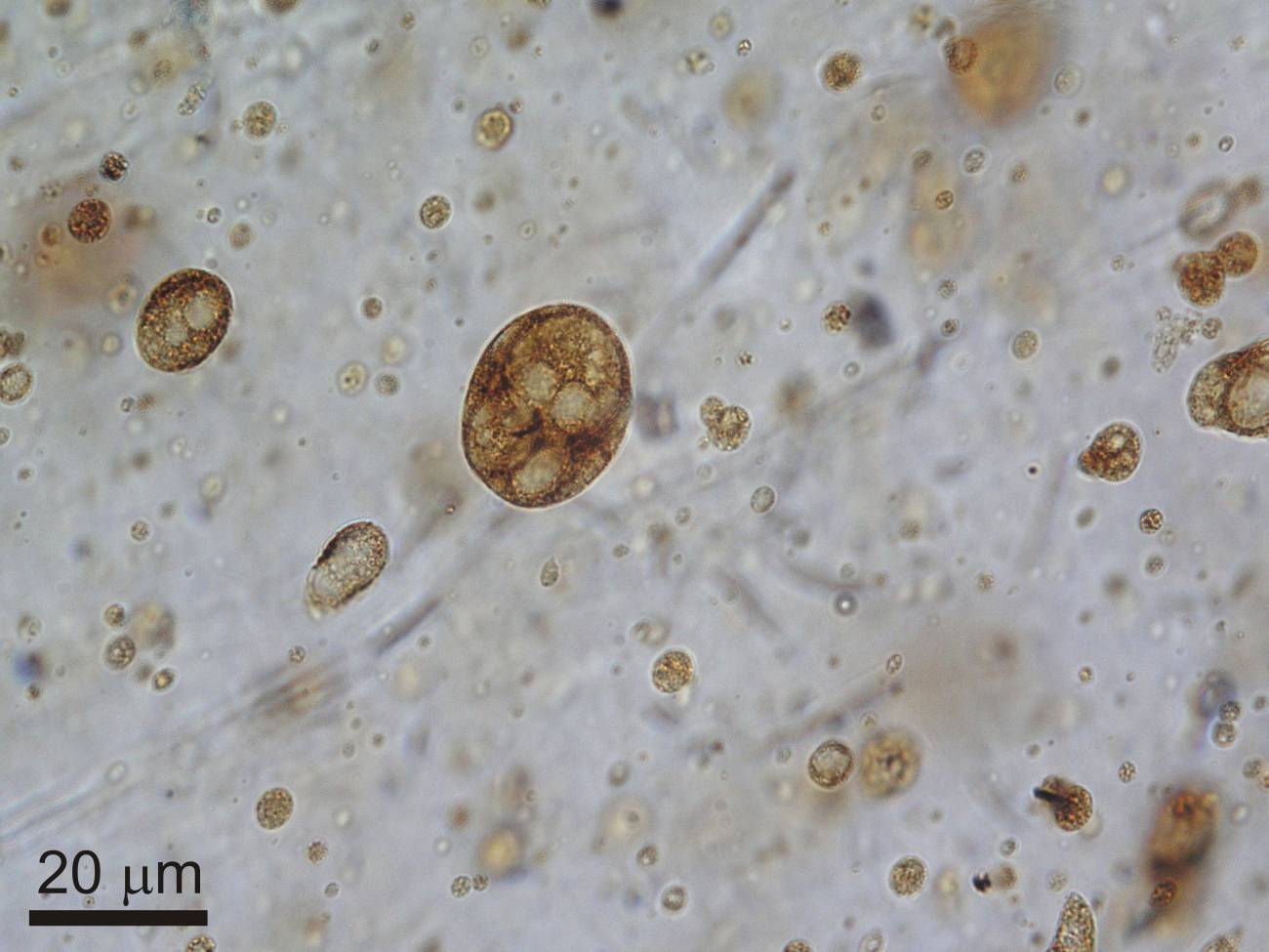 Gotas de savia elaborada de un cuarto del grosor de un cabello conservadas en ámbar de hace 105 millones de años. / Museo Geominero