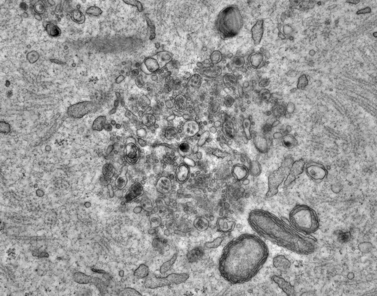 ELVAs fotografiados bajo un microscopio
