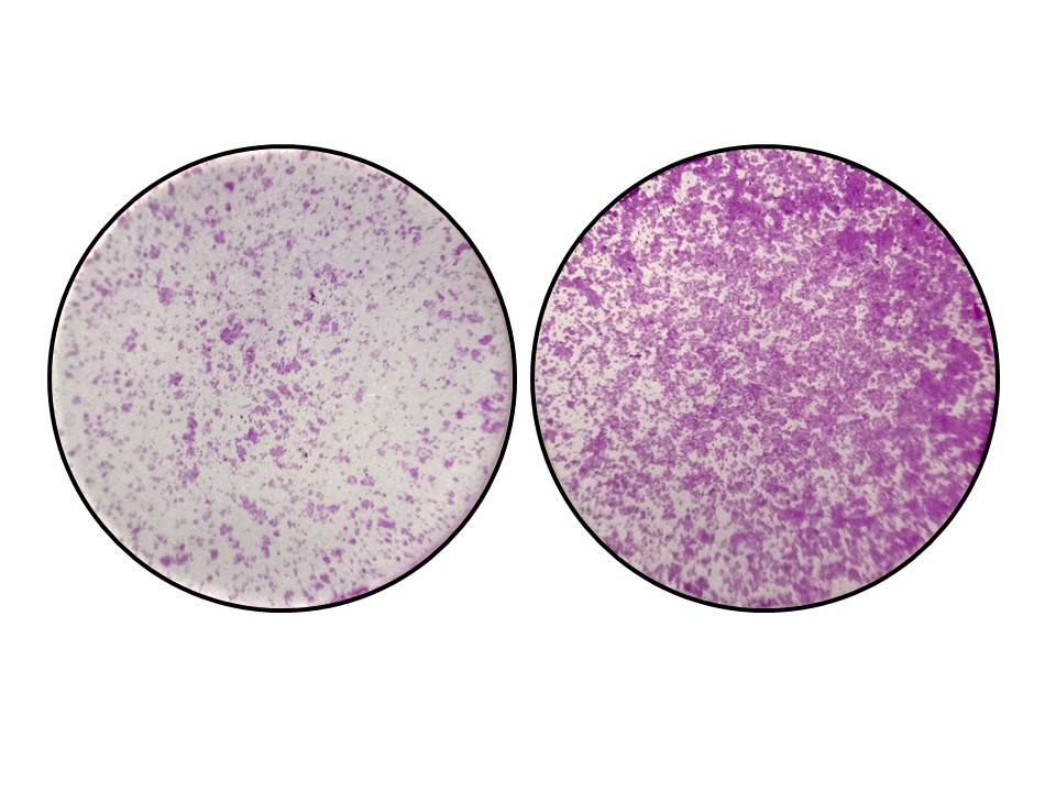 El efecto de perder el gen TYW2 y el nucleótido “Y” en cáncer de colon. En la imagen de la izquierda se observan células del colon con niveles normales de TYW2 y la pieza “Y”. En la imagen de la derecha, cuando sucede la perdida de TYW2 y el nucleótido “Y”, las células del cáncer de colon empiezan a migrar de forma descontrolada.