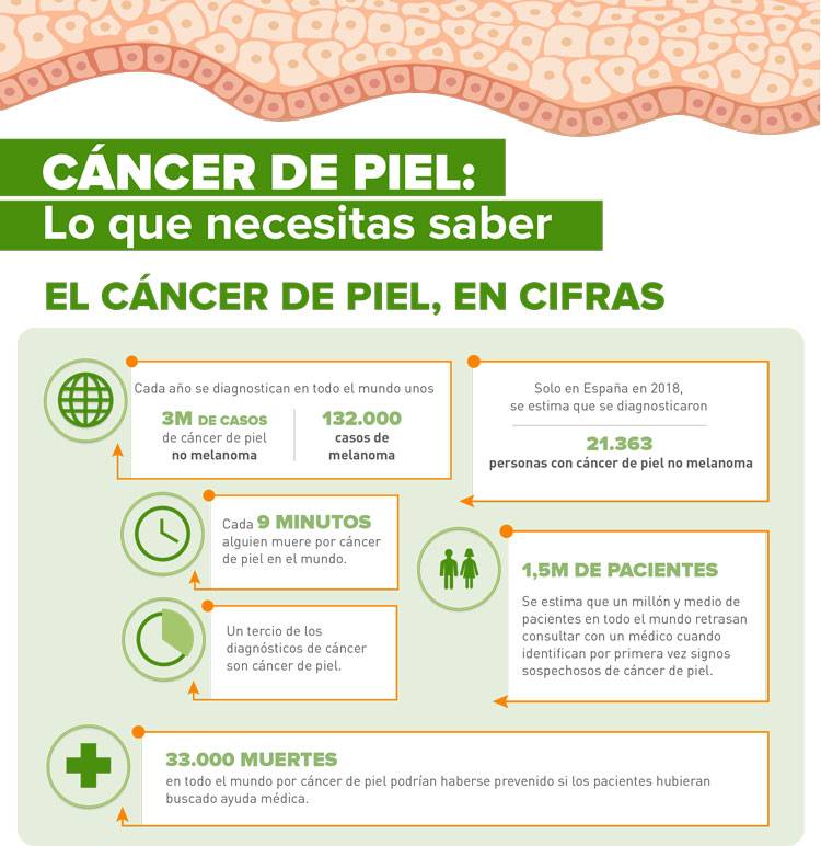 imagen cifras sobre el cáncer de piel en España