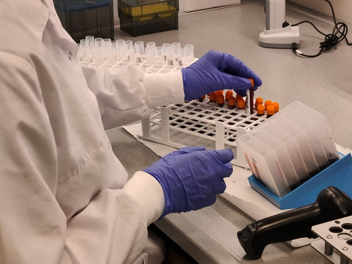 Codificación de las muestras en deCODE genetics. / Eva Rodríguez