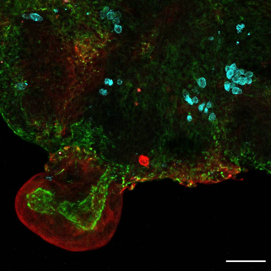 Organoides intestinales a partir de líquido amniótico