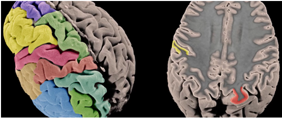 Superficie y grosor de la corteza cerebral