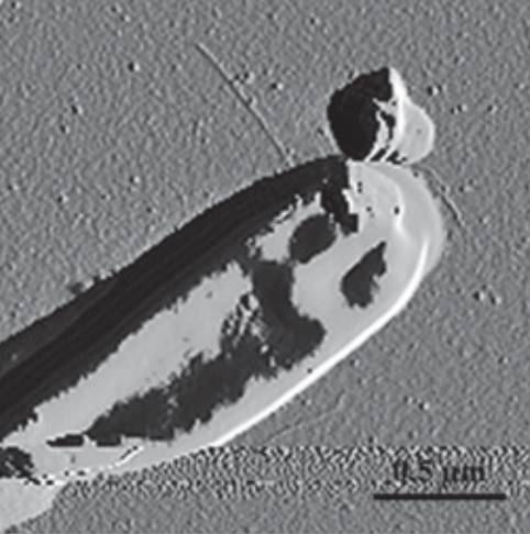 En la imagen, Bifidobacterium bifidus. / PNAS