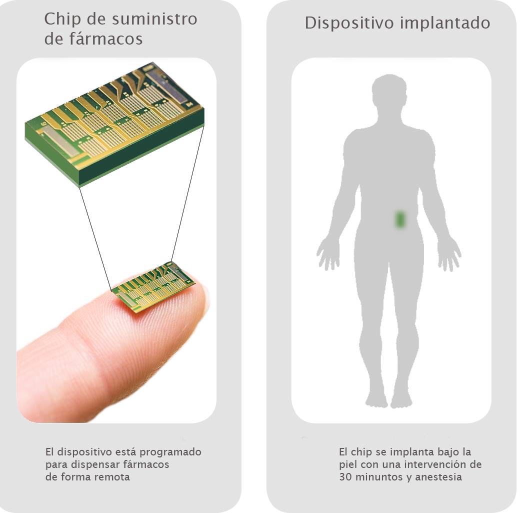 El dispositivo es programable de forma inalámbrica y puede activarse desde un ordenador o un teléfono móvil. Imagen: MicroCHIPS.