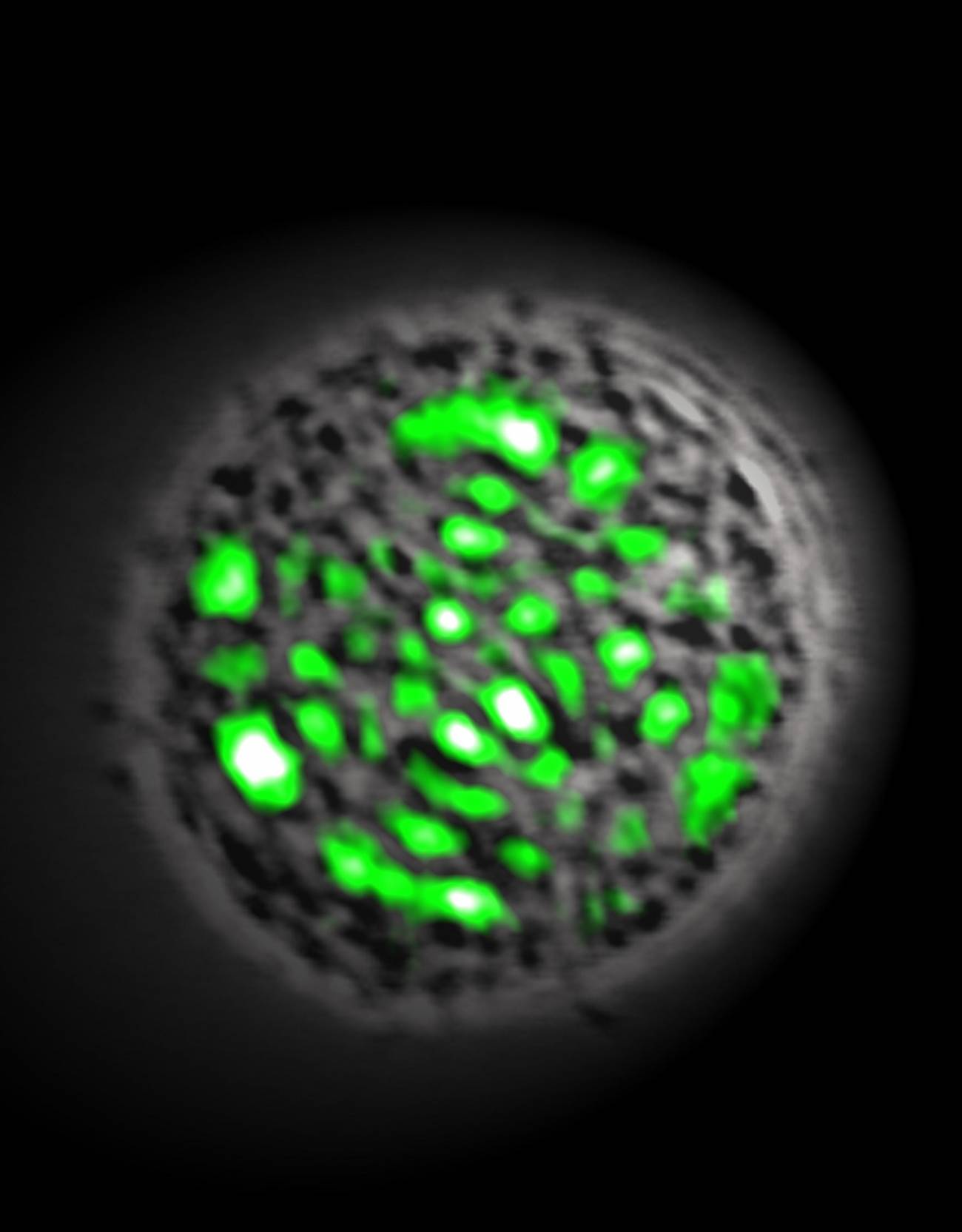 Crean el primer láser celular con proteínas fluorescentes