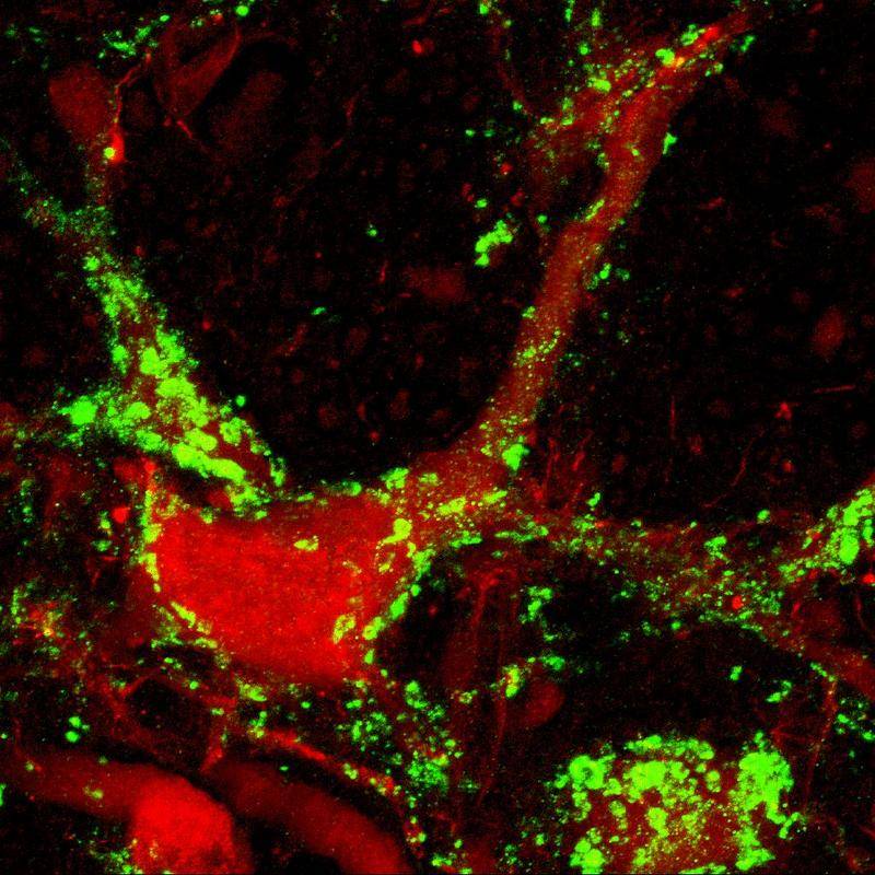 Demuestran la capacidad preventiva de una proteína frente a la esclerosis lateral amiotrófica